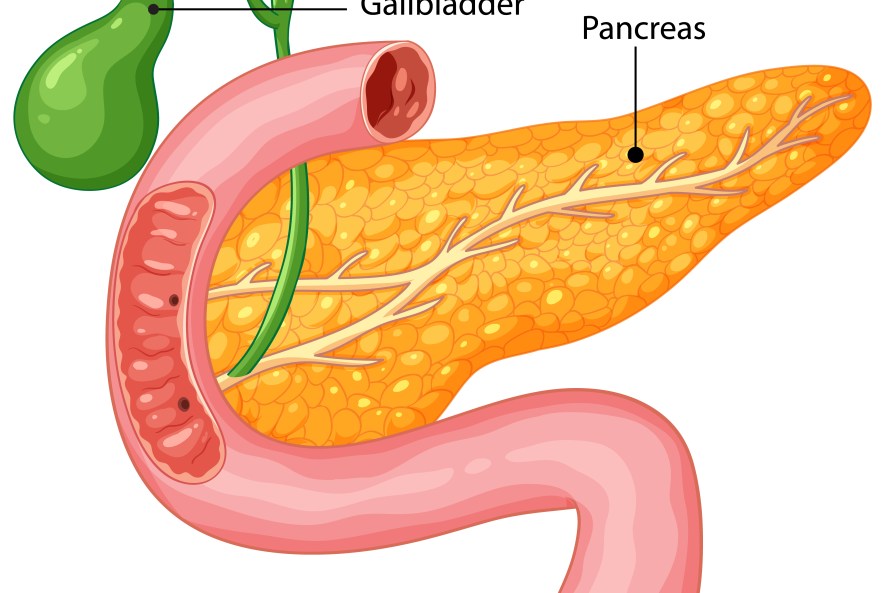 Pankreas Kanseri