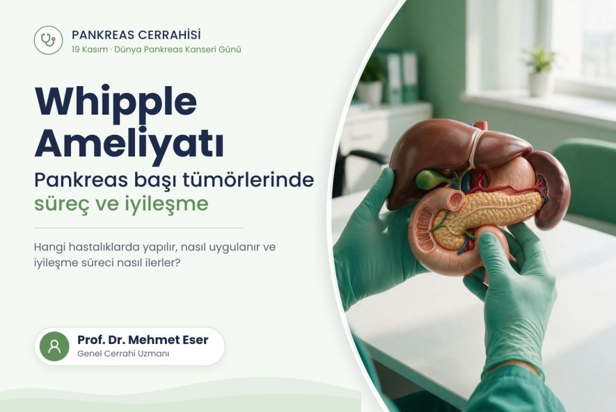 Whipple ameliyatı: pankreas, onikiparmak bağırsağı ve safra yollarını gösteren anatomik model